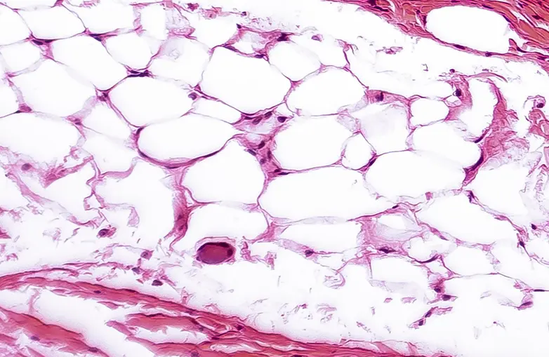 Photo of adipose tissue